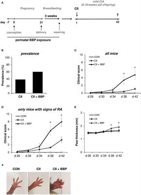 Phthalate Exposure During the Prenatal and Lactational Period Increases the Susceptibility to Rheumatoid Arthritis in Mice